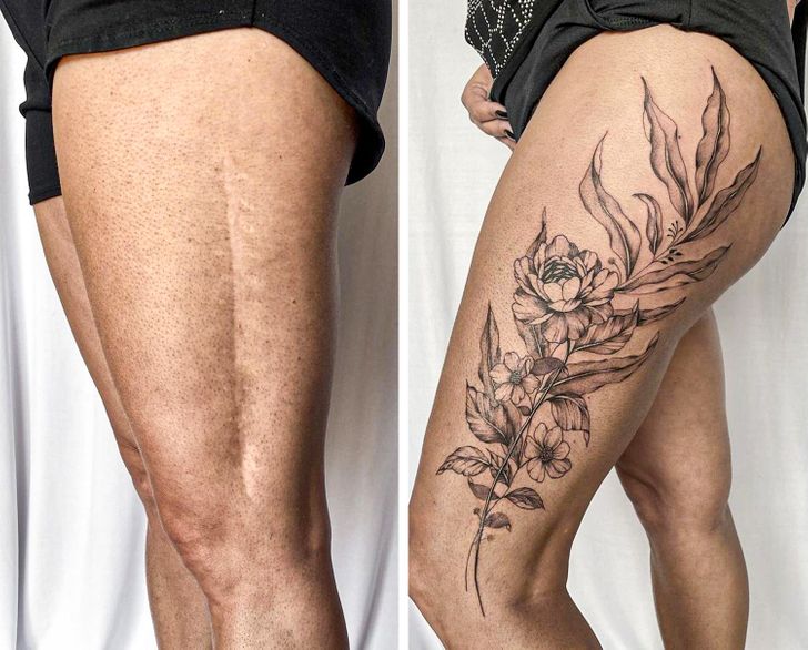 scar cover up tattoo