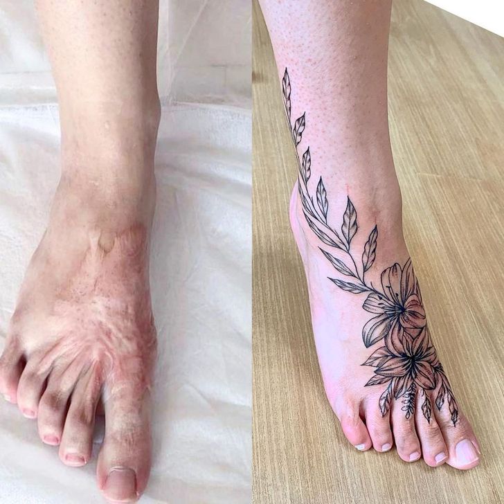 scar cover up tattoo