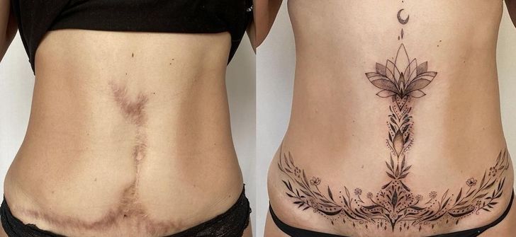 scar cover up tattoo