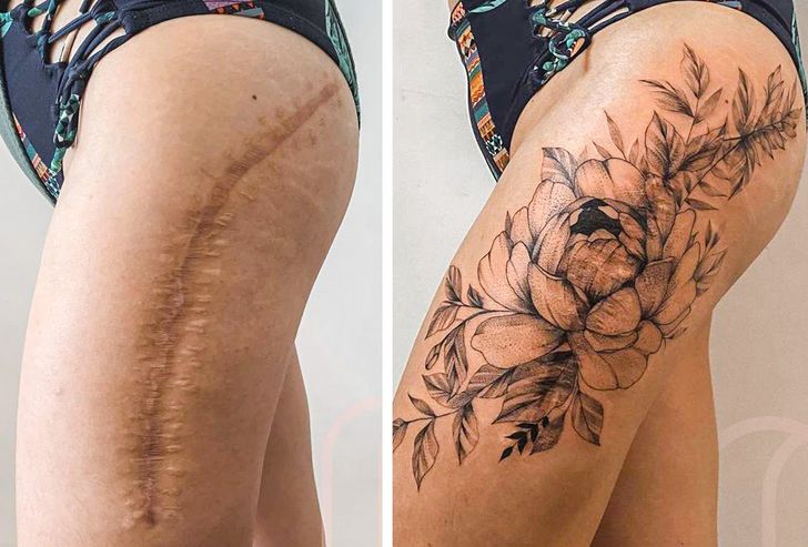 scar cover up tattoo
