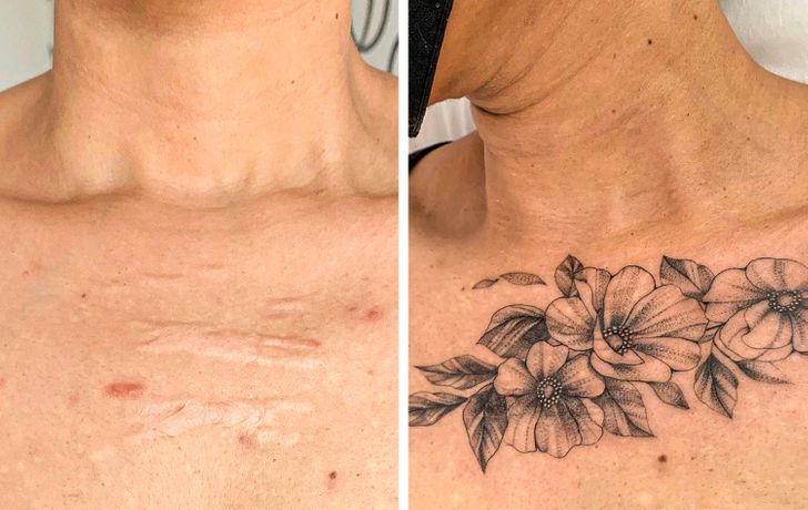 scar cover up tattoo