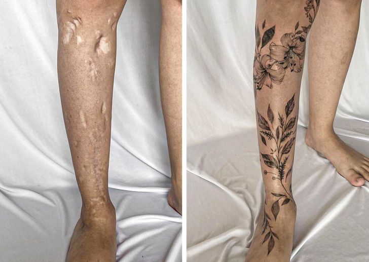 scar cover up tattoo