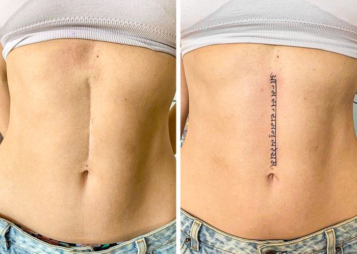scar cover up tattoo
