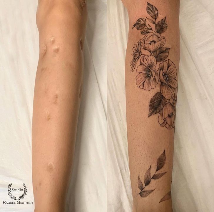 scar cover up tattoo