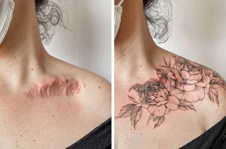scar cover up tattoo