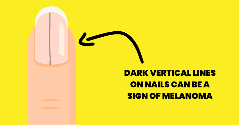 10 Symptoms That May Reveal Health Problems 10 Symptoms That May Reveal Health Problems