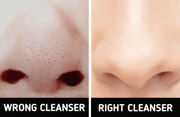 Tighten Large Pores