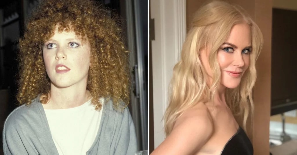 famous people transformation