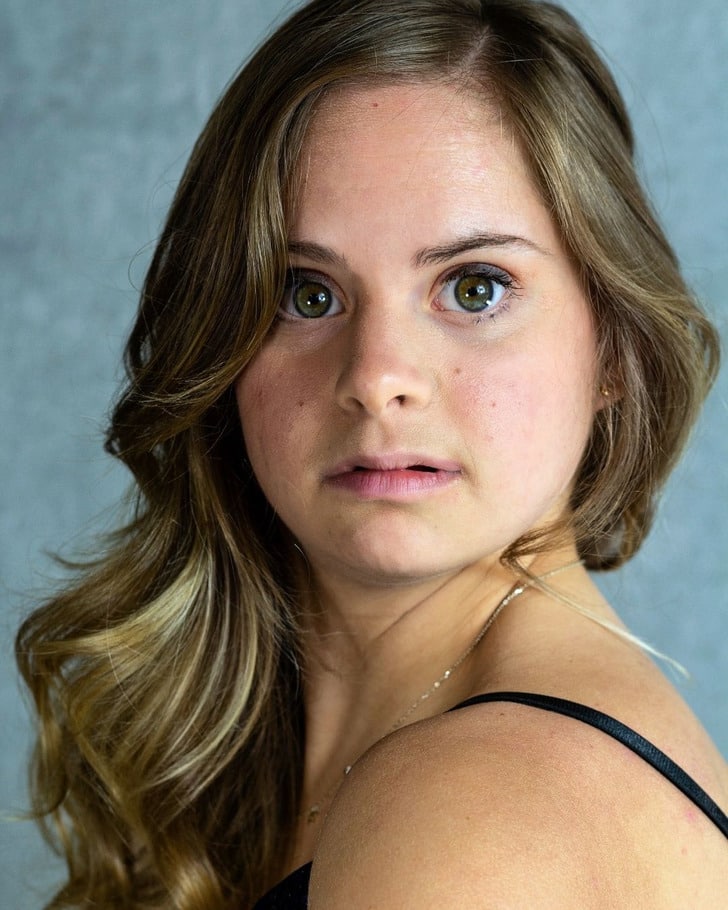 down syndrome model