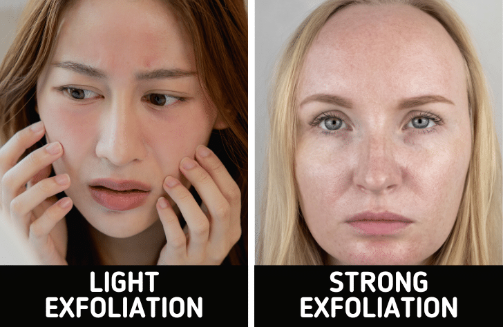 Tighten Large Pores