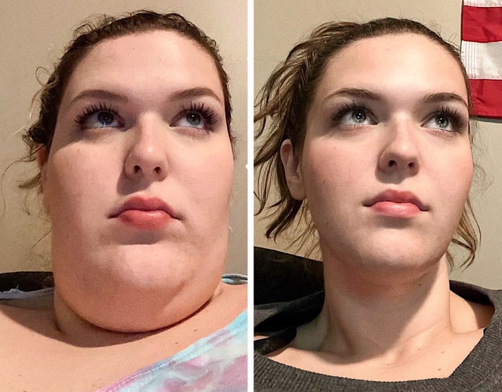 before and after