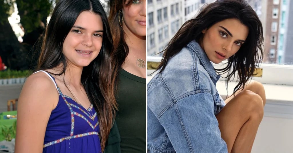 famous people transformation