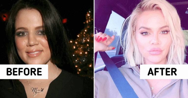 famous people transformation