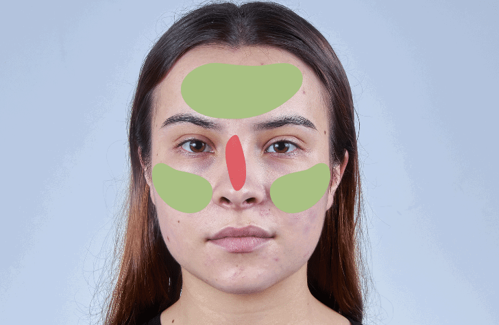 Tighten Large Pores