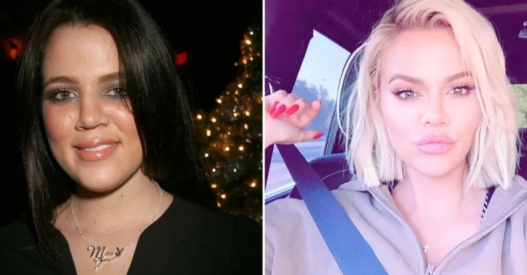 famous people transformation