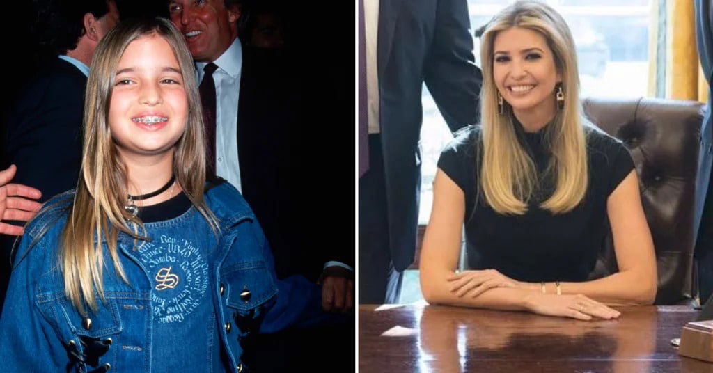 famous people transformation