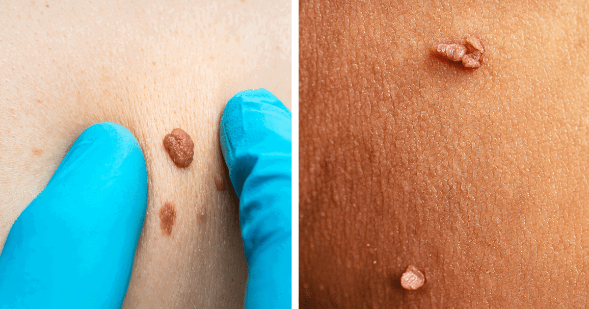 Unusual Signs of Pregnancy