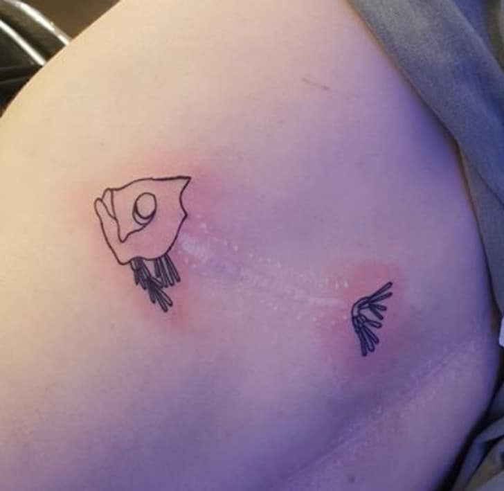 scars cover-up