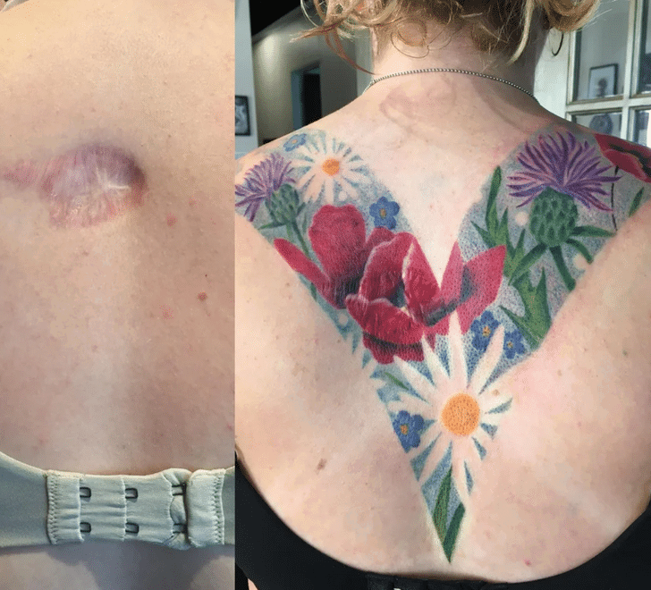 scars cover-up
