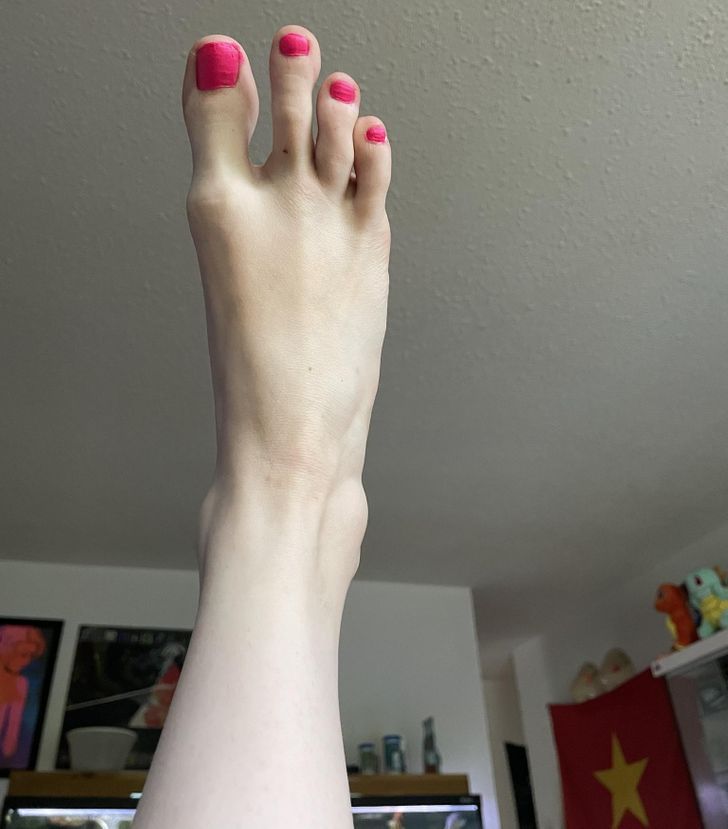 genes