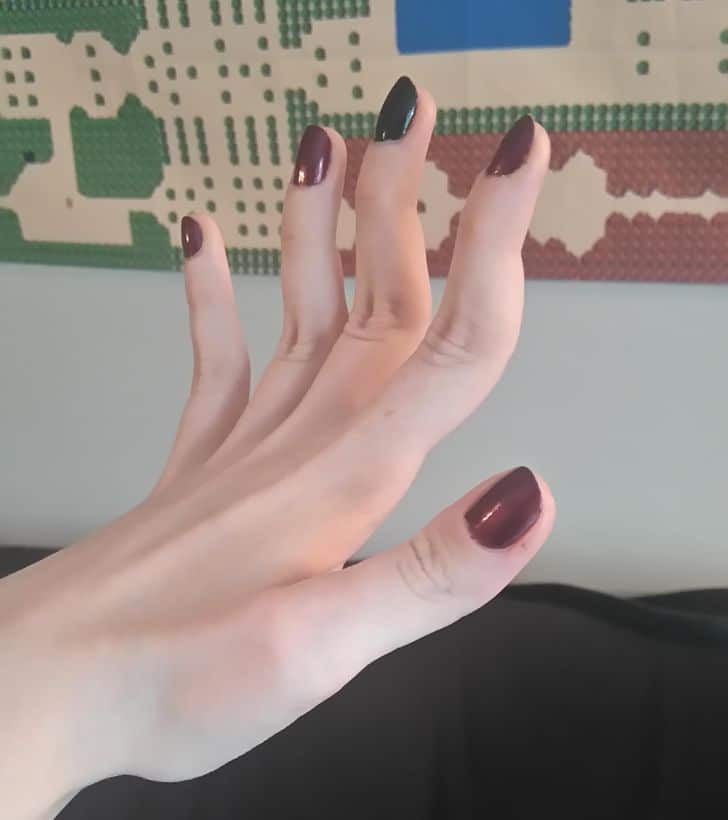 genes