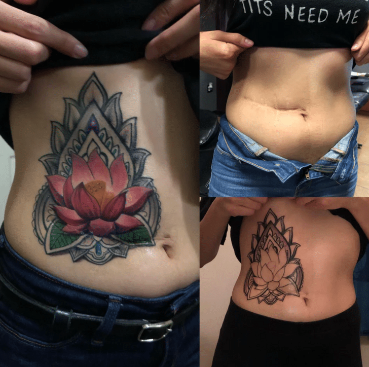 scars cover-up