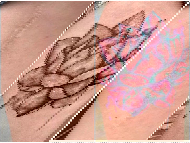 scars cover-up
