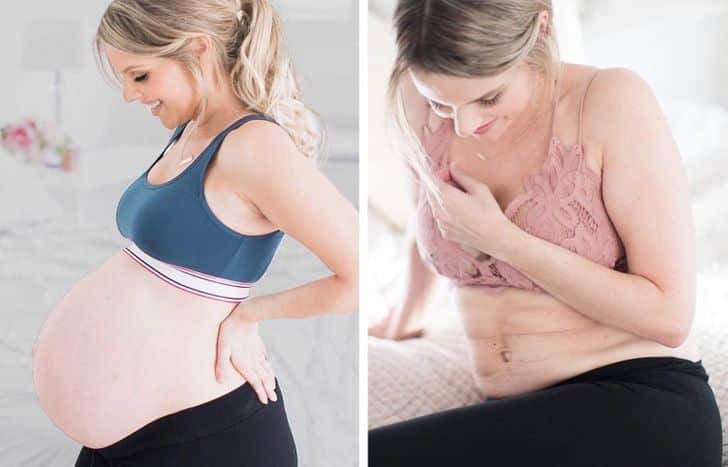 postpartum bodies