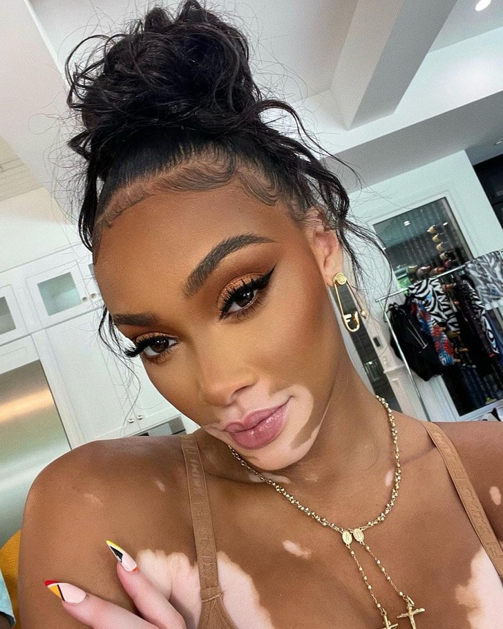 Winnie Harlow