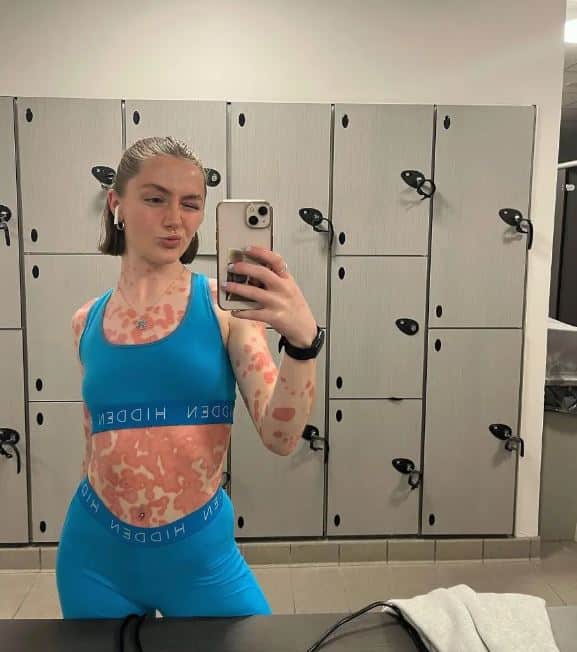 Nurse Ashling Armstrong