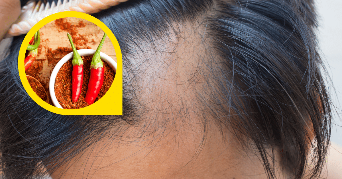 Hair Loss