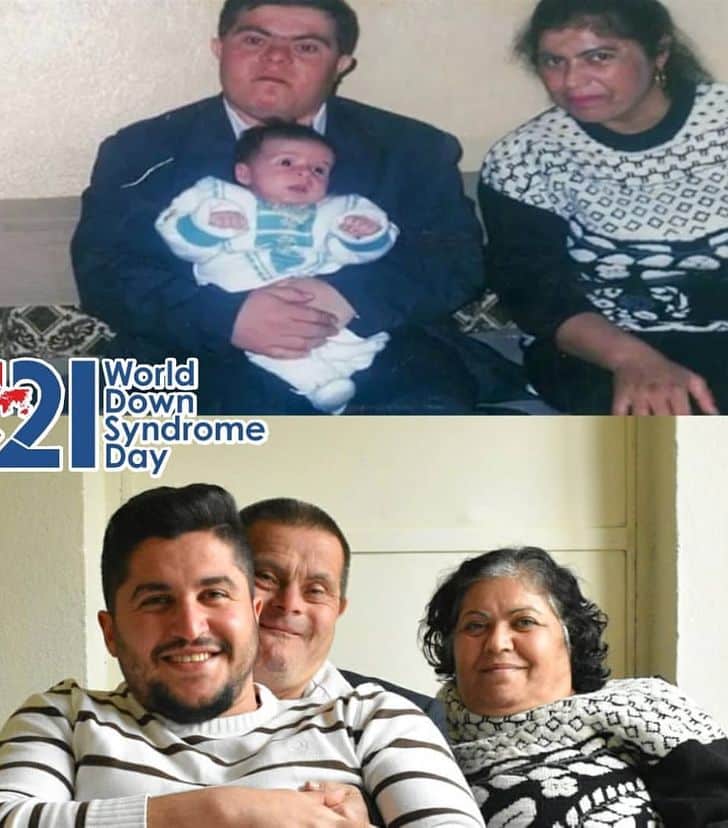Father With Down Syndrome