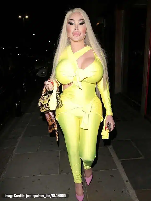 $1M Plastic Surgery TV Star