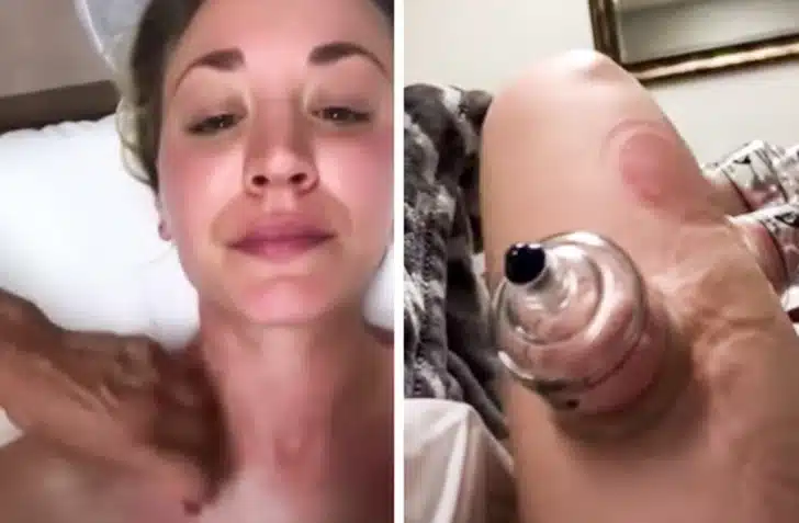 Ancient Healing Therapy