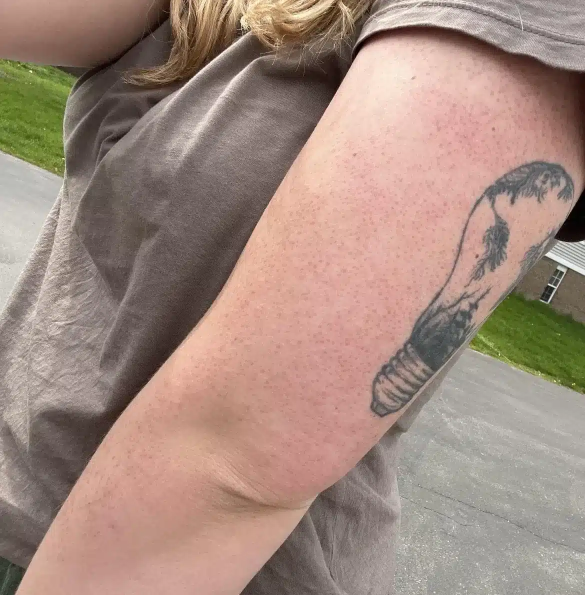 Red Bumps on Your Arms