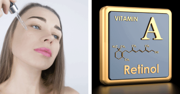Face Pigmentation