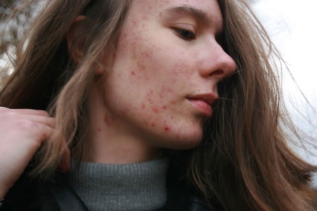 Serious Diseases