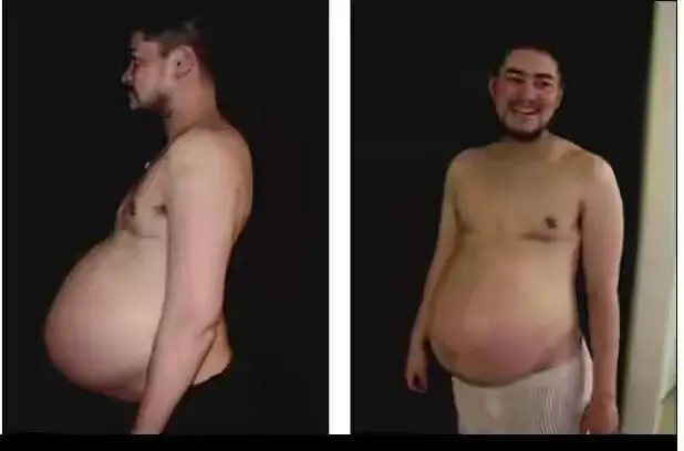 World's First Pregnant Man