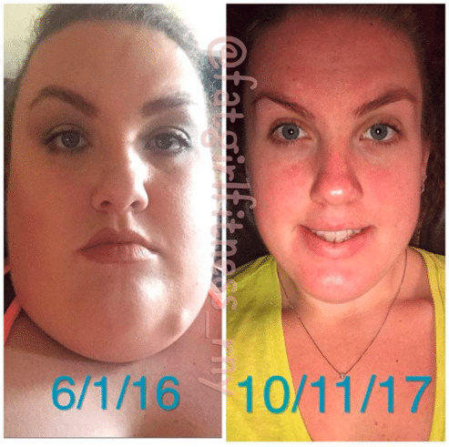 Remarkable Transformation