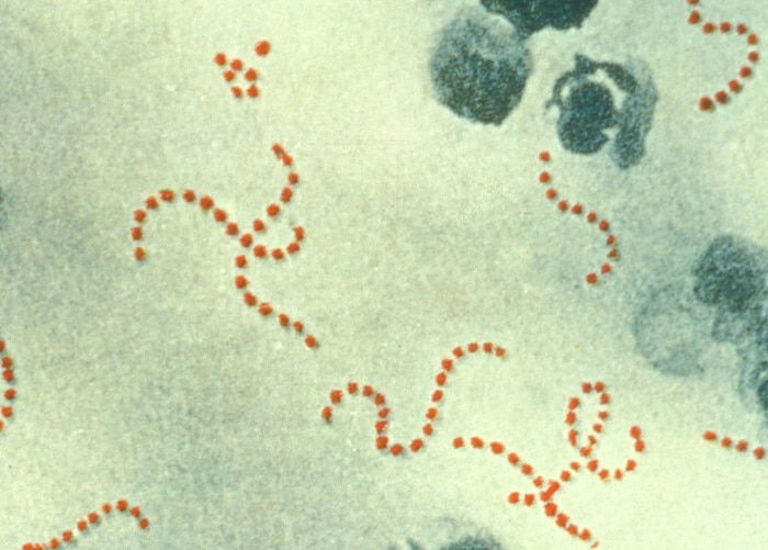 scarlet fever