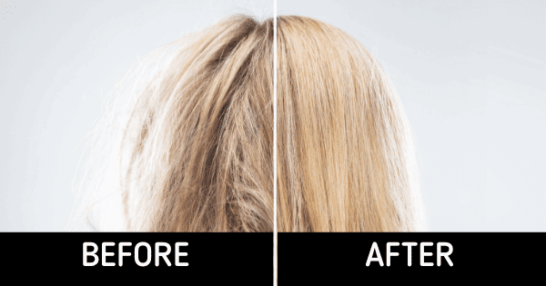 Hair Growth