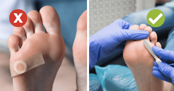 Leg Care