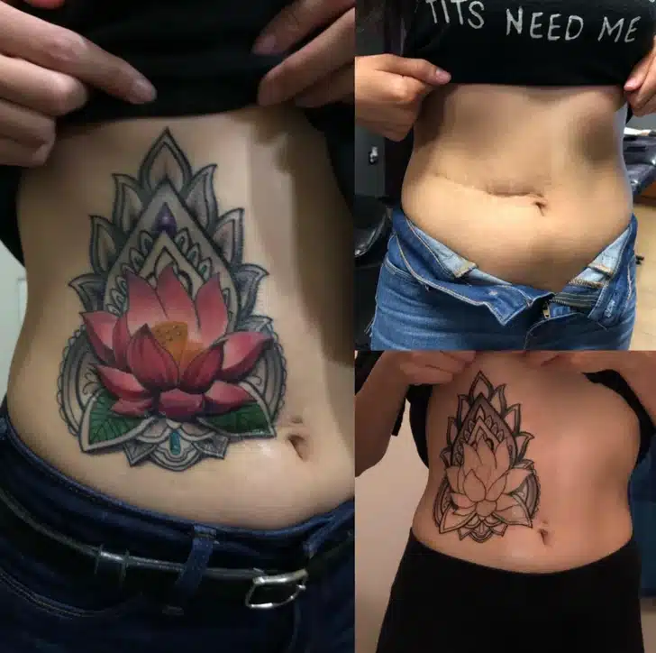 Turning Scars into tattoo
