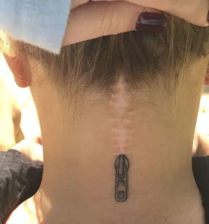 Turning Scars into tattoo