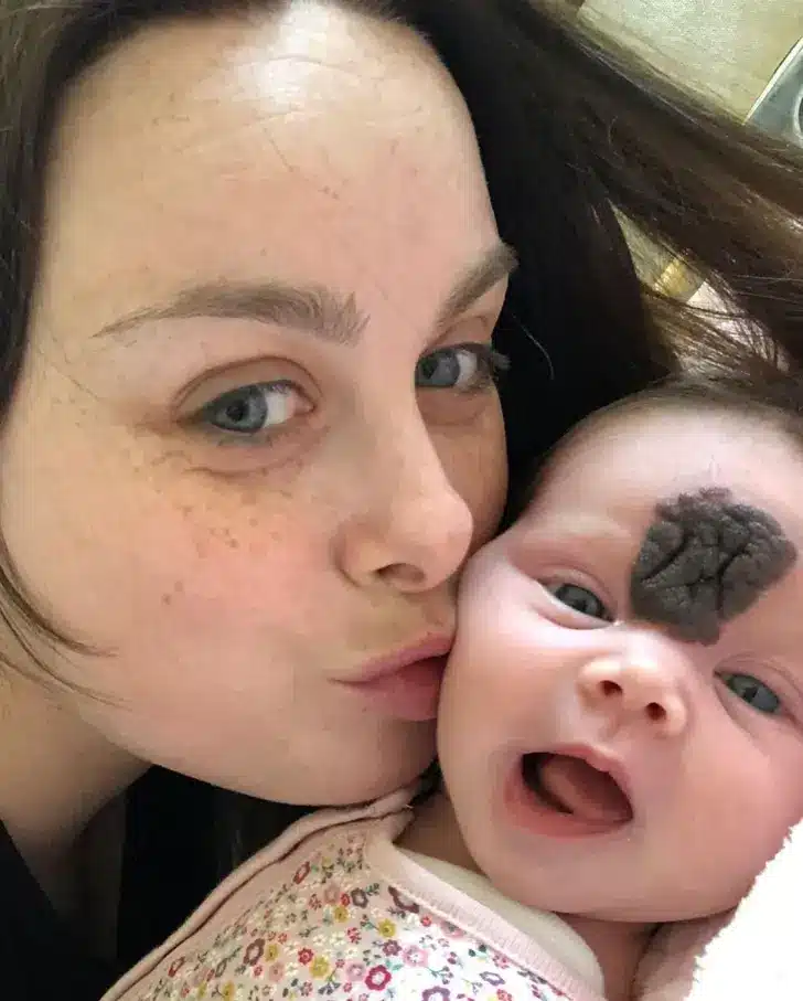 Rare Birthmark