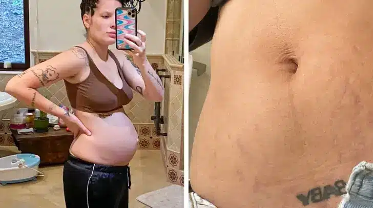 Postpartum Changes