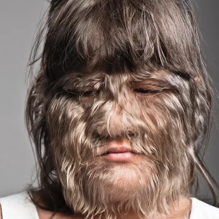 The World's Hairiest Girl