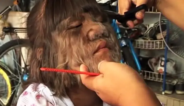 The World's Hairiest Girl