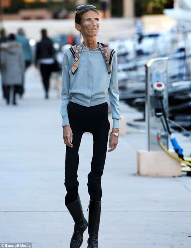 World's Thinnest Woman