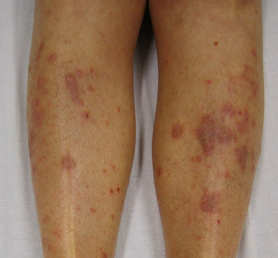 Red Spots